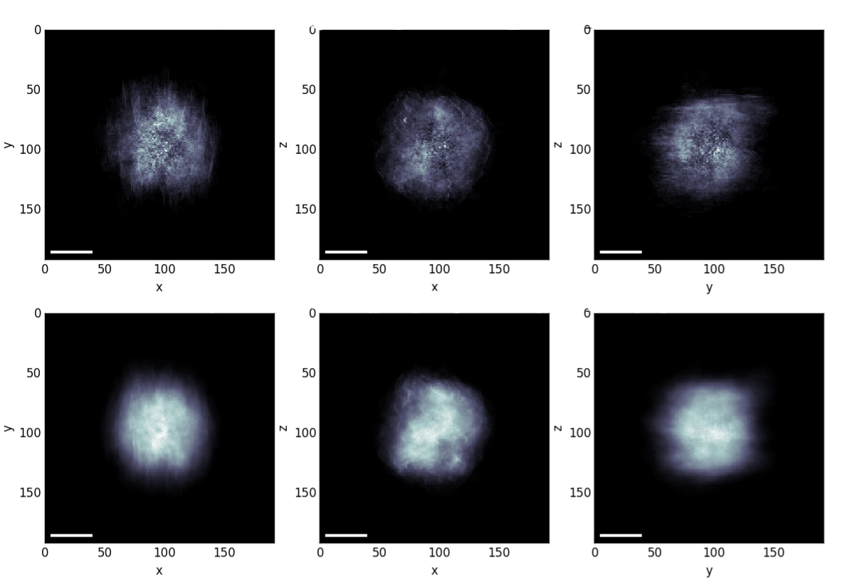 Reconstructed images of 5-μm NPC loaded by 50-nm gold nanoparticles in liquid medium