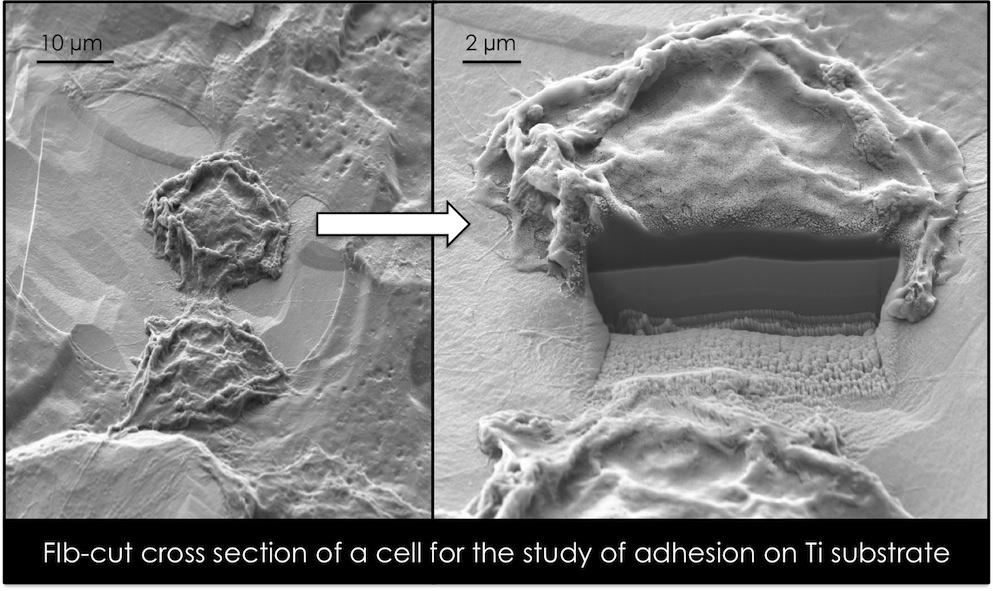 FIB-cut cross section of a cell on Ti substrate