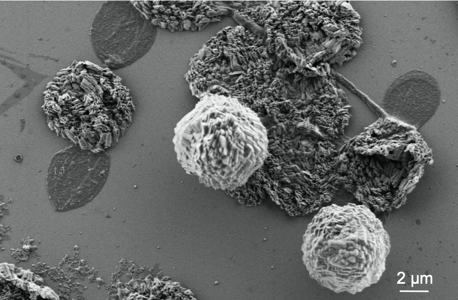 SEM images of alginate/chitosan sodium capsules